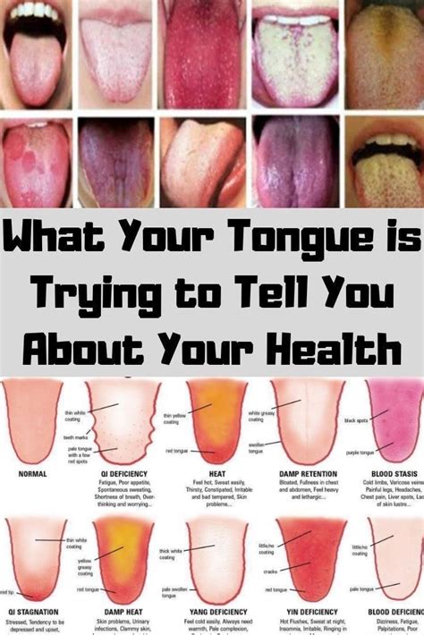 Pin By Dada Oluwaseyi On Health In 2020 Tongue Health Healthy Tongue