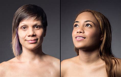 Women Show The Reality Of Their Mastectomies In Stunning Photos Erika Stallings