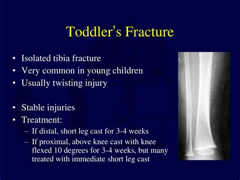 Ppt Fractures Of The Tibia And Fibula In The Pediatric Patient