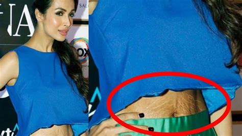 Young Celebrities With Stretch Marks