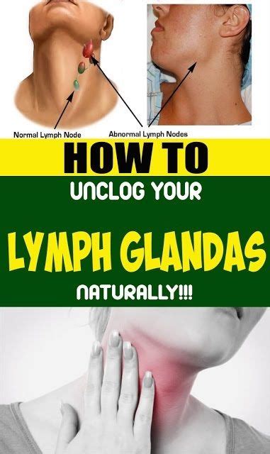 The Most Effective Method To Unclog Your Lymph Glands Naturally In 2020