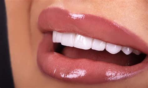 Smile Makeover Plan Options For A Gummy Smile Scenic City Dentistry Chattanooga Tennessee