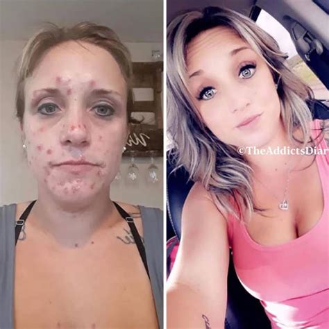 How Drug Addiction Looks Before And After Pics Izismile Com