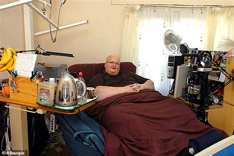 Former Worlds Fattest Man Begs Nhs For £100000 Surgery To Save Life