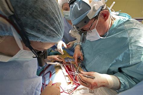 Christopher malaisrie, md, and witness open heart surgery by one of the best cardiology and heart surgery programs. Open-heart surgery - Stock Image - C021/8315 - Science ...