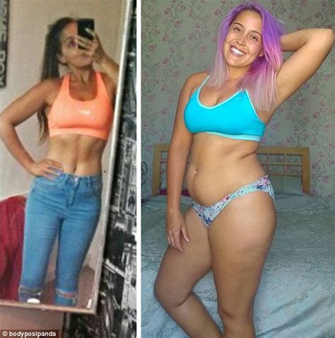 Recovered Anorexia Sufferer Megan Jayne Crabbe From Essex Details Self Loathing Struggle