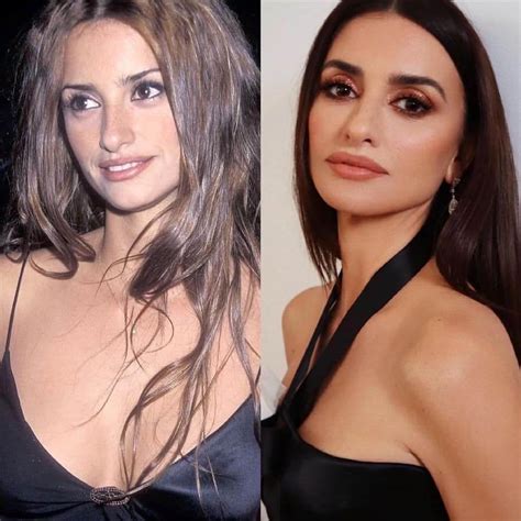 Penelope Cruz Plastic Surgery Before And After
