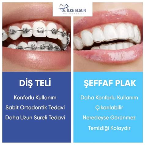 Effaf Di Plak Invisalign Tedavisi Ve Fiyatlar