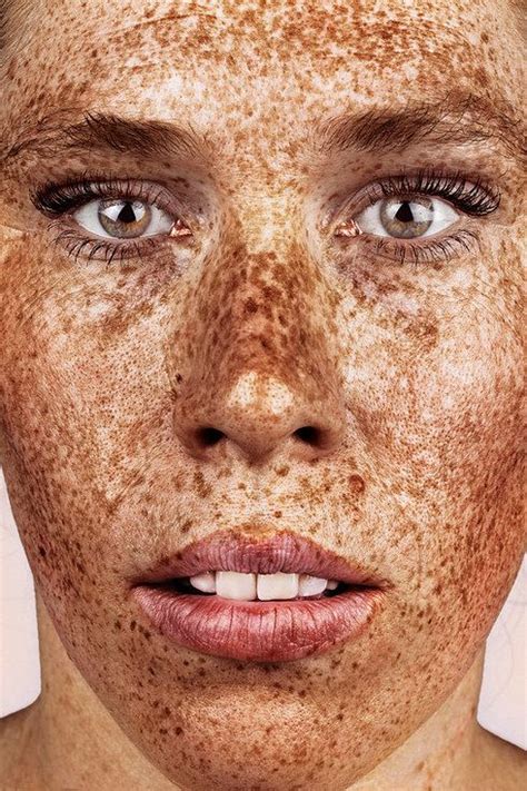 These Portraits Celebrate The Joy Of Having Freckles Beautiful Freckles Freckles Freckle Face