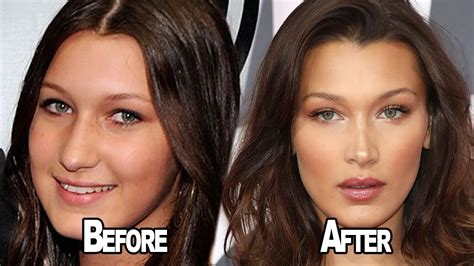 bella hadid before bella hadid before and after plastic surgery celebrity
