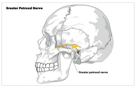 Anatomy Head And Neck Greater Petrosal Nerve Statpearls Ncbi