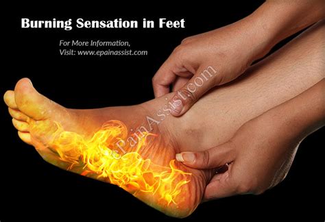 This accumulated fluid exerts extra pressure on the nerves causing pain and burning sensation in the feet. Burning Sensation in Feet|Causes|Treatment|Prevention ...