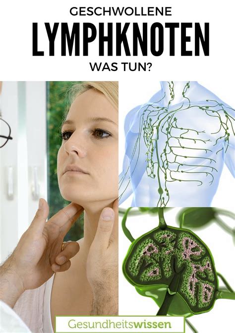Wann sollte man zum arzt? Geschwollene Lymphknoten: Es gibt viele Auslöser ...