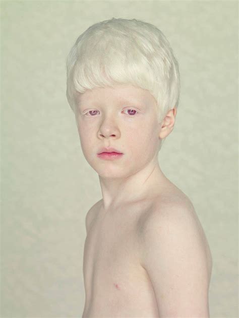 Pin Em Albinism Leucism Isabellinism