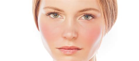 Red Face Or Rosacea Symptoms Advanced Dermatology Of Midlands