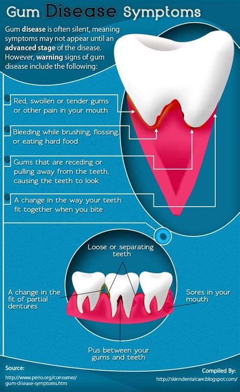 symptoms of gum diseases [infographic] visual ly gum disease symptoms dental health gum