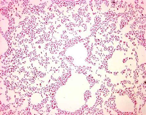 E Coli Gram Stain Microbiology Pinterest Stains