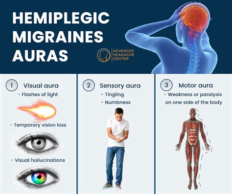 Hemiplegic Migraine Treatment Specialist In Nyc And Nj Advanced Headache Center