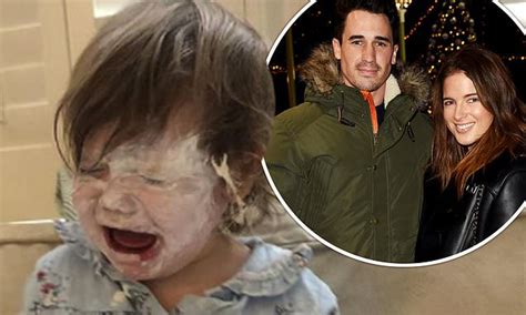 Binky Felstead Shares Photo India Covered In Sudocrem Daily Mail Online