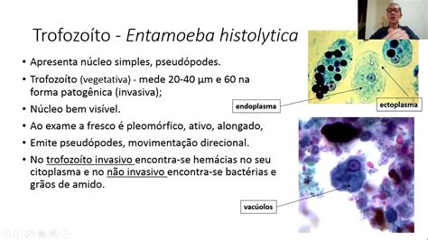 12 AULA PRÁTICA 1 Entamoeba histolytica morfologia patogenias e