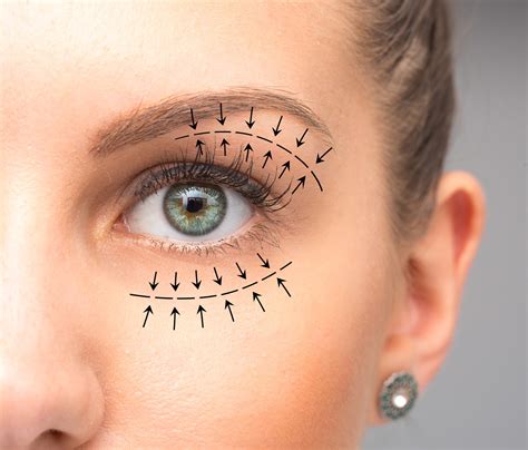 Will You Have Visible Scarring After Blepharoplasty Dr Grant