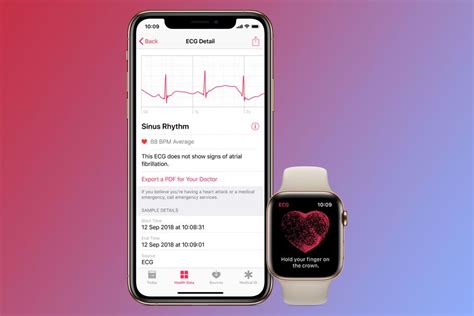 What Is Apple Watch Ecg And How Do You Set It Up