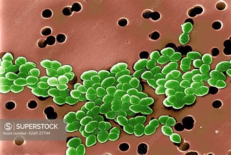 Vancomycin Resistant Enterococcus Color Enhanced Scanning Electron