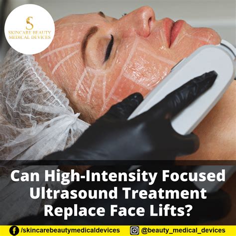 Can High Intensity Focused Ultrasound Treatment Replace Face Lifts
