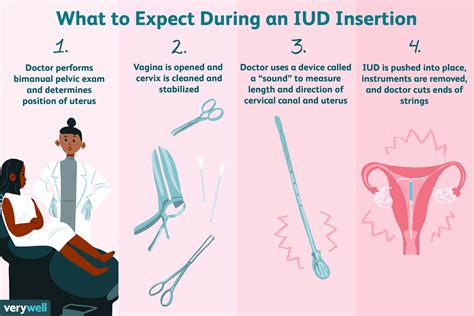Iud Insertion What To Expect Procedure Protection
