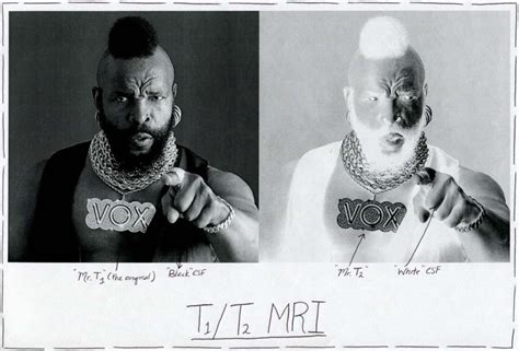 Conversely, a t1 scan shows fat as being whiter. T1/T2 and Mr. T. | Neurology, Educational resources, This ...