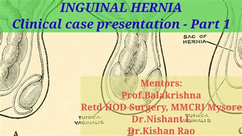 Inguinal Hernia Part 1 Youtube
