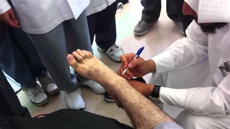 Review Of Orthopedic Ankle And Foot Examinations Youtube