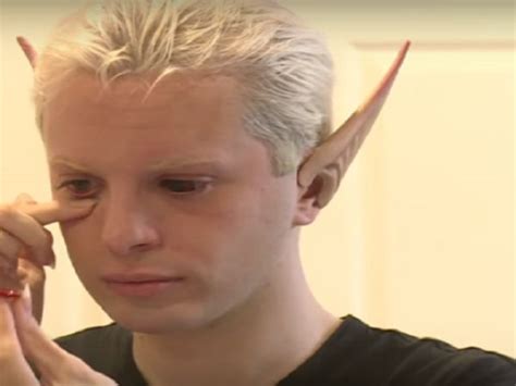 Man Spends 30 000 On Plastic Surgery To Become An Elf