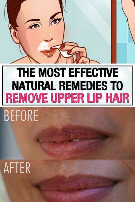 The Most Effective Natural Remedies To Remove Upper Lip Hair Upper