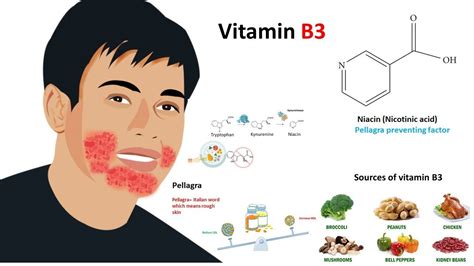 Vitamin Deficiency Rash
