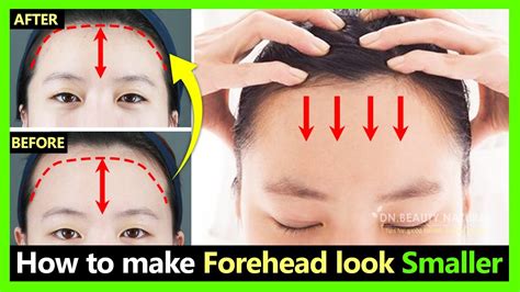 How To Fix Big Wide Forehead Make Forehead Smaller Naturally Shrink