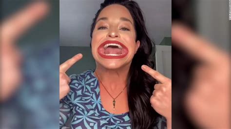 See The Woman Guinness World Records Says Has The Biggest Mouth Cnn Video