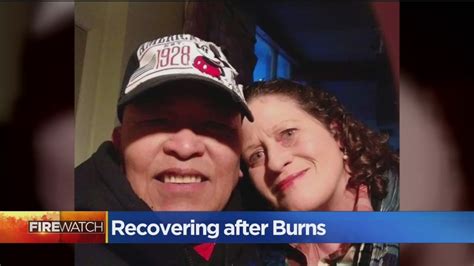 Camp Fire Burn Victims Road To Recovery Youtube