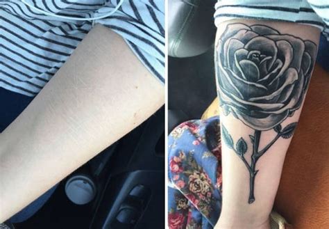Fernando hideki) the transformative impact his tattoos have had on people's lives has inspired. Amazing Tattoos That Covered Up Scars With Interesting ...