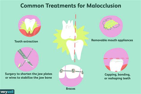 What Is Malocclusion