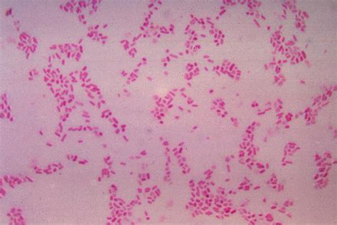 Microbiology 101 The Gram Stain Outbreak News Today