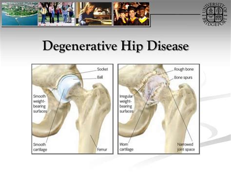 Ppt Hip Joint Orthopaedic Tests Orthopedics Dx 611 Powerpoint