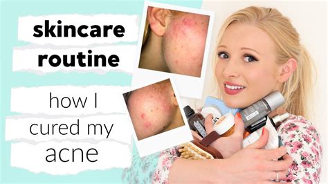 My Full Skin Care Routine And How I Cured My Acne Youtube