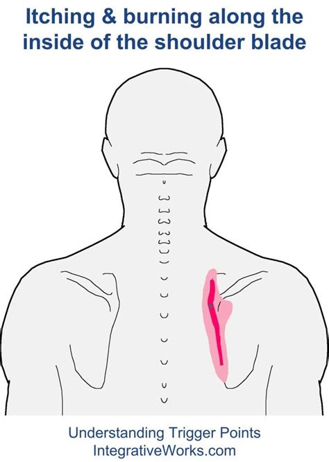 How To Release A Pinched Nerve In Shoulder Blade