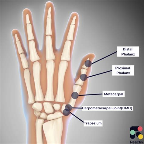 Surgery For Thumb Arthritis What Are The Options Reactiv Blog