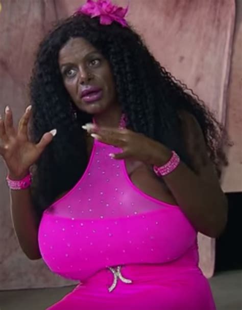 White Model Who Identifies As Black Martina Big Now Has Boobs That Weigh The Same As A Crate Of