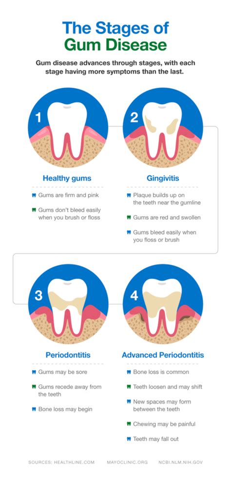 What Causes Periodontitis And How To Treat It Smartmouth