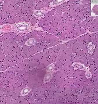 Parotid Histology