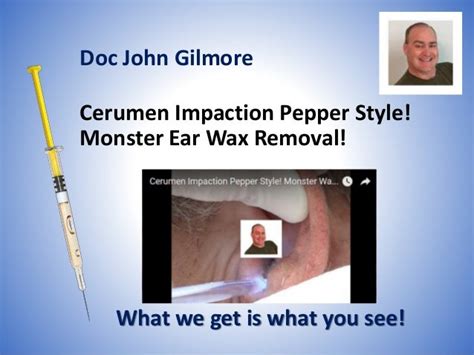 Cerumen Impaction Pepper Style Monster Ear Wax Removal