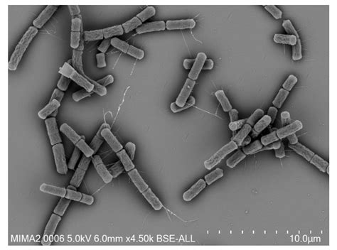Sensors Free Full Text Advanced Methods For Detection Of Bacillus